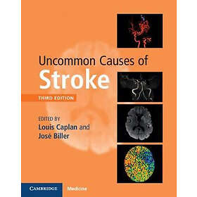 Louis Caplan: Uncommon Causes of Stroke