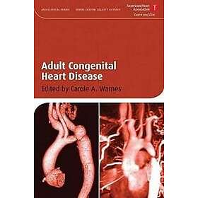 C Warnes: Adult Congenital Heart Disease