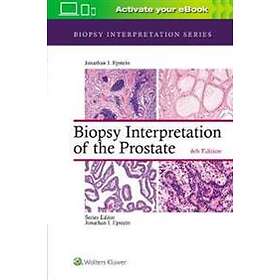 Jonathan I Epstein: Biopsy Interpretation of the Prostate