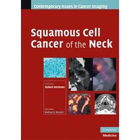 Robert Hermans: Squamous Cell Cancer of the Neck