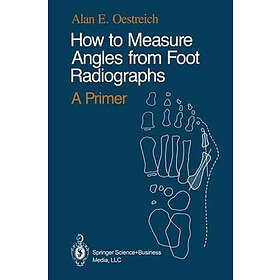Alan E Oestreich: How to Measure Angles from Foot Radiographs