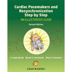 SS Barold: Cardiac Pacemakers and Resynchronization Step by An Illustrated Guide 2e
