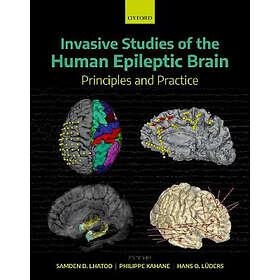 Samden D Lhatoo: Invasive Studies of the Human Epileptic Brain