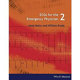 A Mattu: ECGs for the Emergency Physician 2e