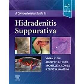 Vivian Y Shi: A Comprehensive Guide to Hidradenitis Suppurativa