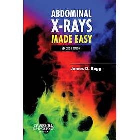 James D Begg: Abdominal X-Rays Made Easy
