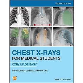 C Clarke: Chest X-rays for Medical Students CXRs Made Easy 2nd Edition
