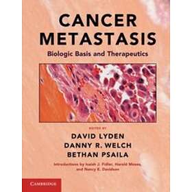 David Lyden: Cancer Metastasis