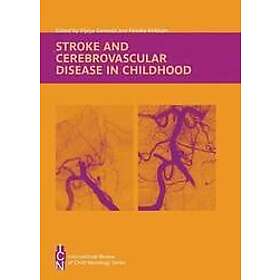 Vijeya Ganesan: Stroke and Cerebrovascular Disease in Childhood