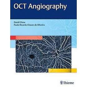 David Chow: OCT Angiography