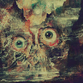 Teratoma Purulent Manifestations LP