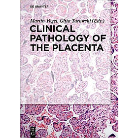 Martin Vogel, Gitta Turowski: Clinical Pathology of the Placenta
