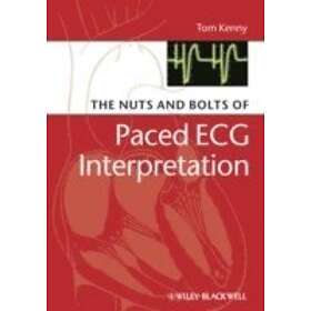 T Kenny: The Nuts and Bolts of Paced ECG Interpretation