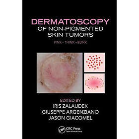 Iris Zalaudek, Giuseppe Argenziano, Jason Giacomel: Dermatoscopy of Non-Pigmente