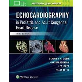 Echocardiography in Pediatric and Adult Congenital Heart Disease