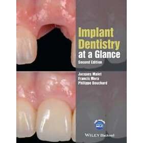 Implant Dentistry at a Glance, 2nd Edition